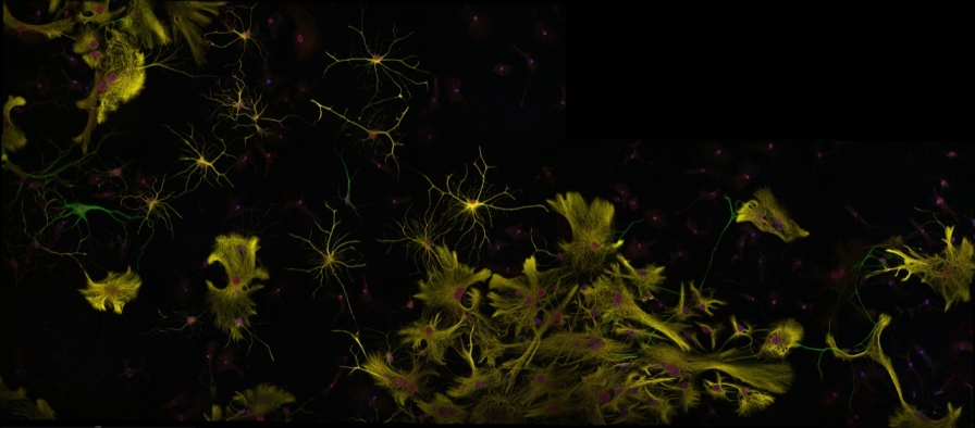 Neurons (green) and astrocytes (yellow) in culture (Image: Ben Tuck)